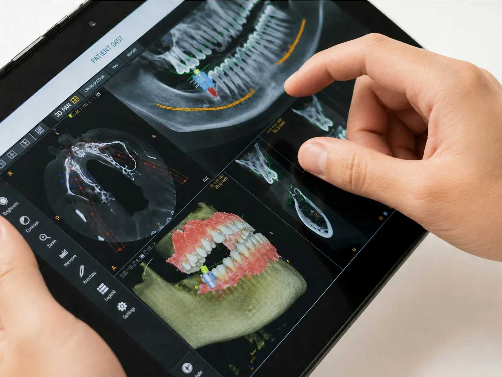 Operatore al lavoro su software CAD dentale 3D